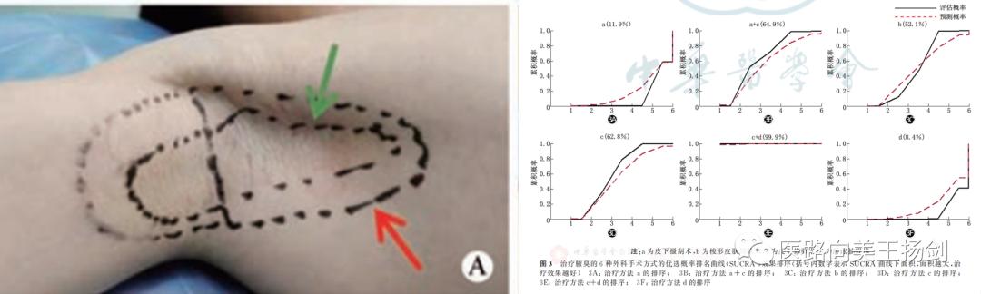 狐臭研究新突破，颠覆传统认知，探索治疗新途径