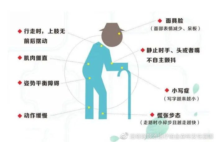 帕金森最新治疗方法概述